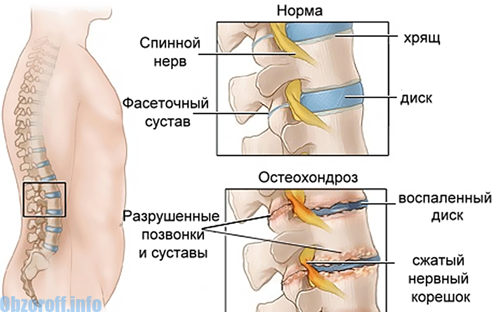 Kuidas ravida kate ja jalgade liigeste valu Osteopaatia liigeste ravi