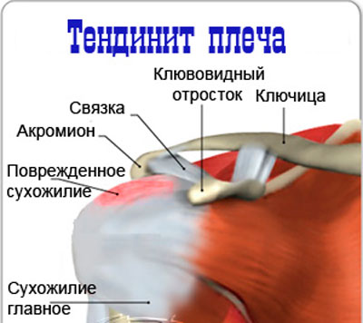 Duphastoni spin valutab Salv valu kaela ja ola liigese