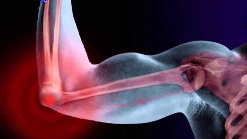 Spin raakis valus Osteopaatia liigeste ravi