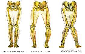 Parim tootja glukosamiini chondroitina Osteoartriit vaikeste liigeste kaes kaes ravi