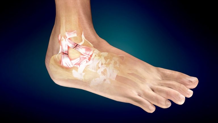 Kuidas ravida kate ja jalgade liigeste valu