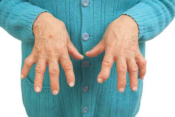 Trichopoli liigeste raviks Milline ravi ola liigese artroosiga