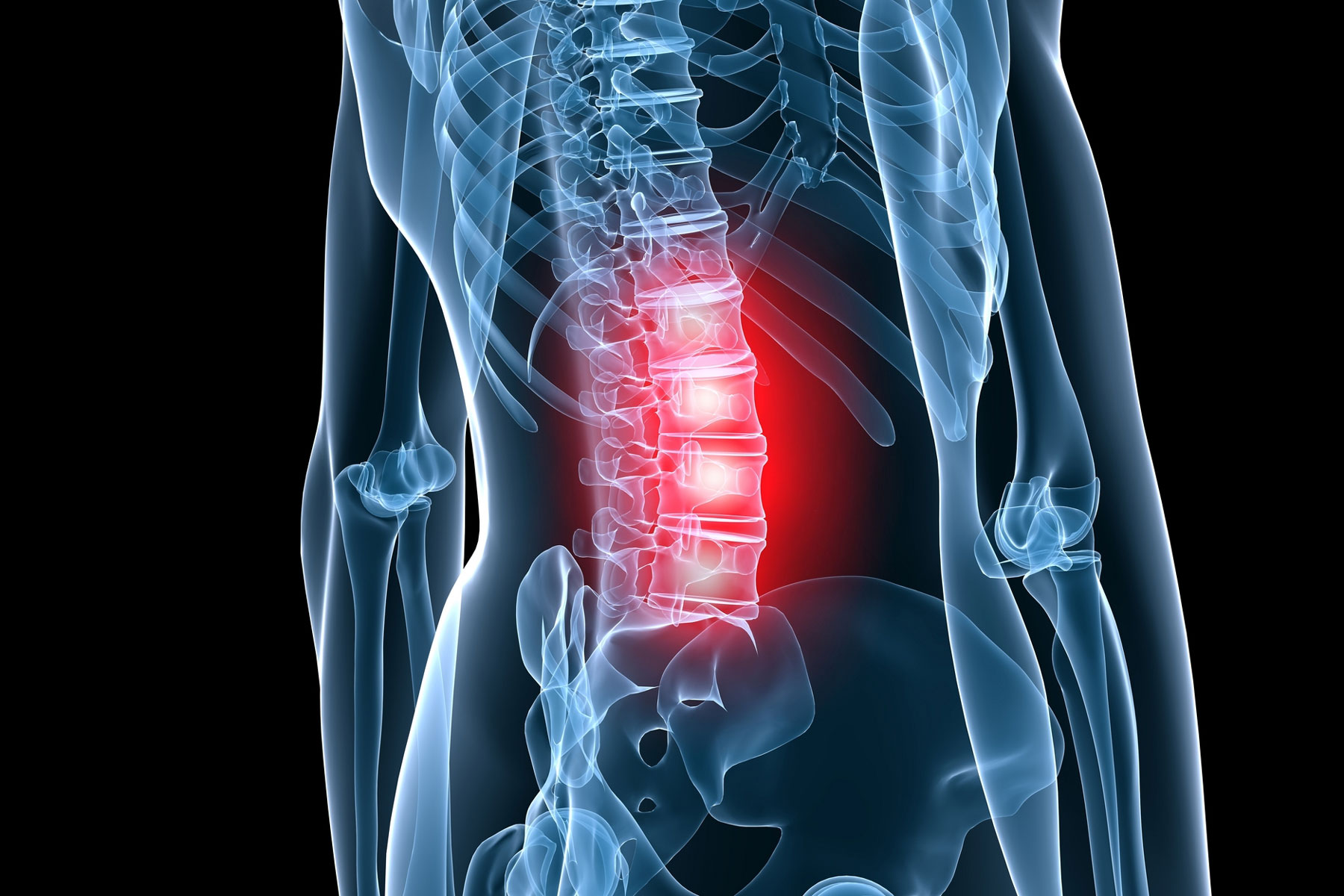 Osteokondroosi salvi vordlus valu ja kihelus liigestes