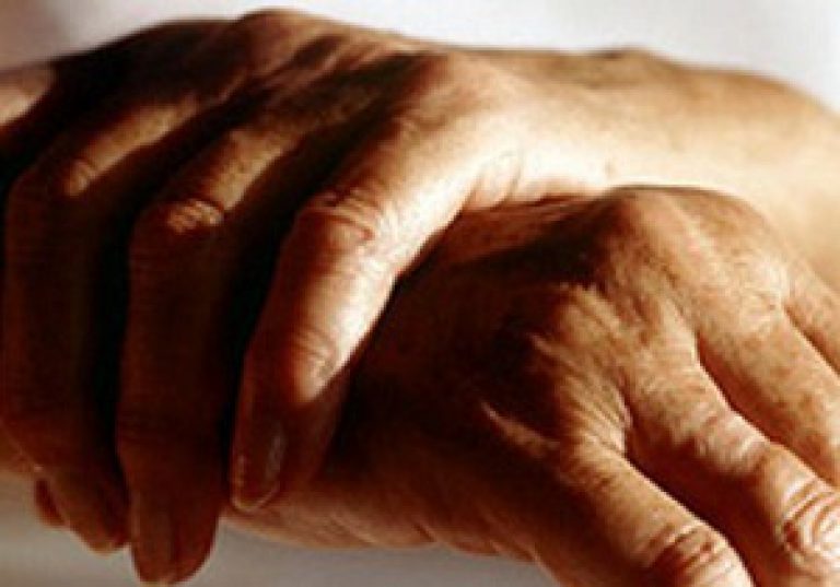 Artriidi turse liigesed Haiget harja sorme liigese