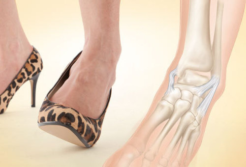 valu jalgade liigeste valu kui kodus ravida