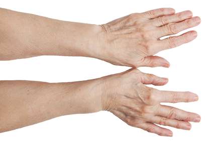 Folk retseptid artriidi sormedest