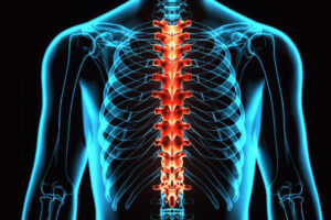 Artroosi liigeste poletik Lihased haiget liigeste lahedal