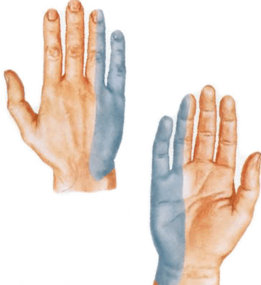 Mazi sormeotste ravi liigeste jaoks Koigi sormede artriit