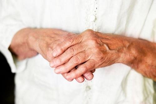 Suurte sormede artriidi ravi kodus