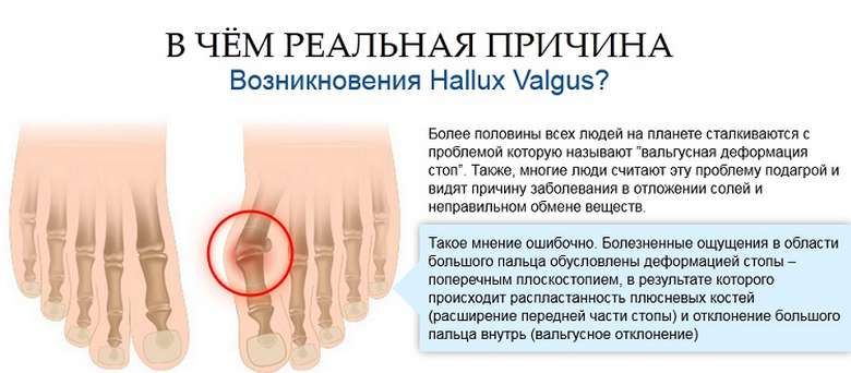 Valutab liigese jalgade ravi Mis ussid liiguvad liigestele haiget