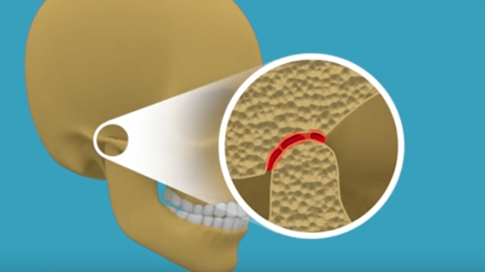 suu ei avane liigese valus Kolab luud ja liigesed pohjustab ravi