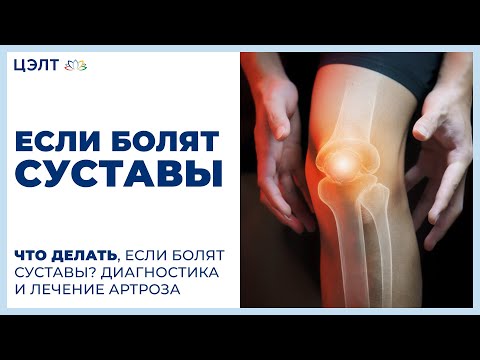 RIB ristloikete artroos Artriit jala sormedes
