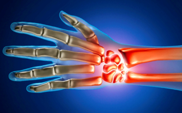 Valu olaliigese vasakpoolse tuimus sormede Kuidas ravida allergilist artriit