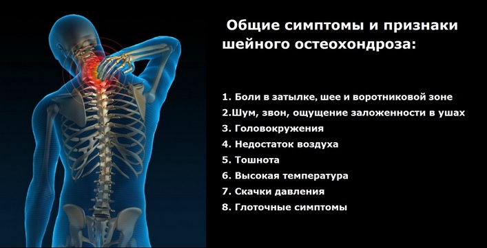 Osteokondroos salvi tagaosa Mis on toodeldud artrotside luud